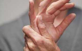 Симптомы полиартрита кистей рук