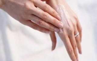 Причины и лечение варикоза на руках