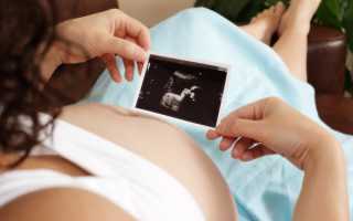 УЗИ в 6 акушерских недель беременности: деликатные подробности