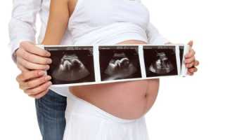 Нормы ультразвукового исследования на 30-31 неделе беременности