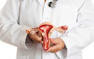 Характер менструации при миоме матки. Как остановить сильные выделения?