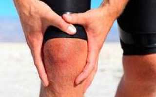 Как снять опухоль с коленного сустава