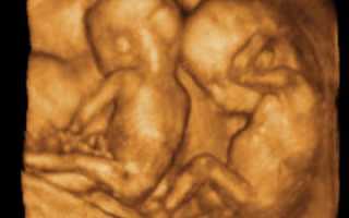 Необычное УЗИ в 4d: кто и зачем его делает во время беременности