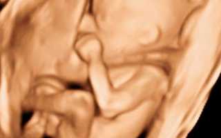 3D УЗИ во время беременности для продвинутых родителей