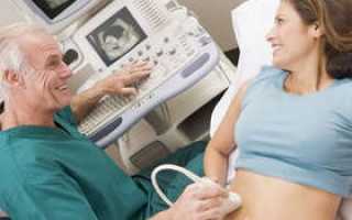 Стоит ли делать УЗИ на 16-17 неделе беременности