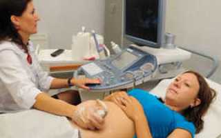 Ответы на все вопросы о скрининговом УЗИ при беременности