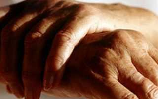 Лечение суставов пальцев рук